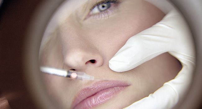 Renewing Skin Without Surgical Procedure Via Dermal Fillers