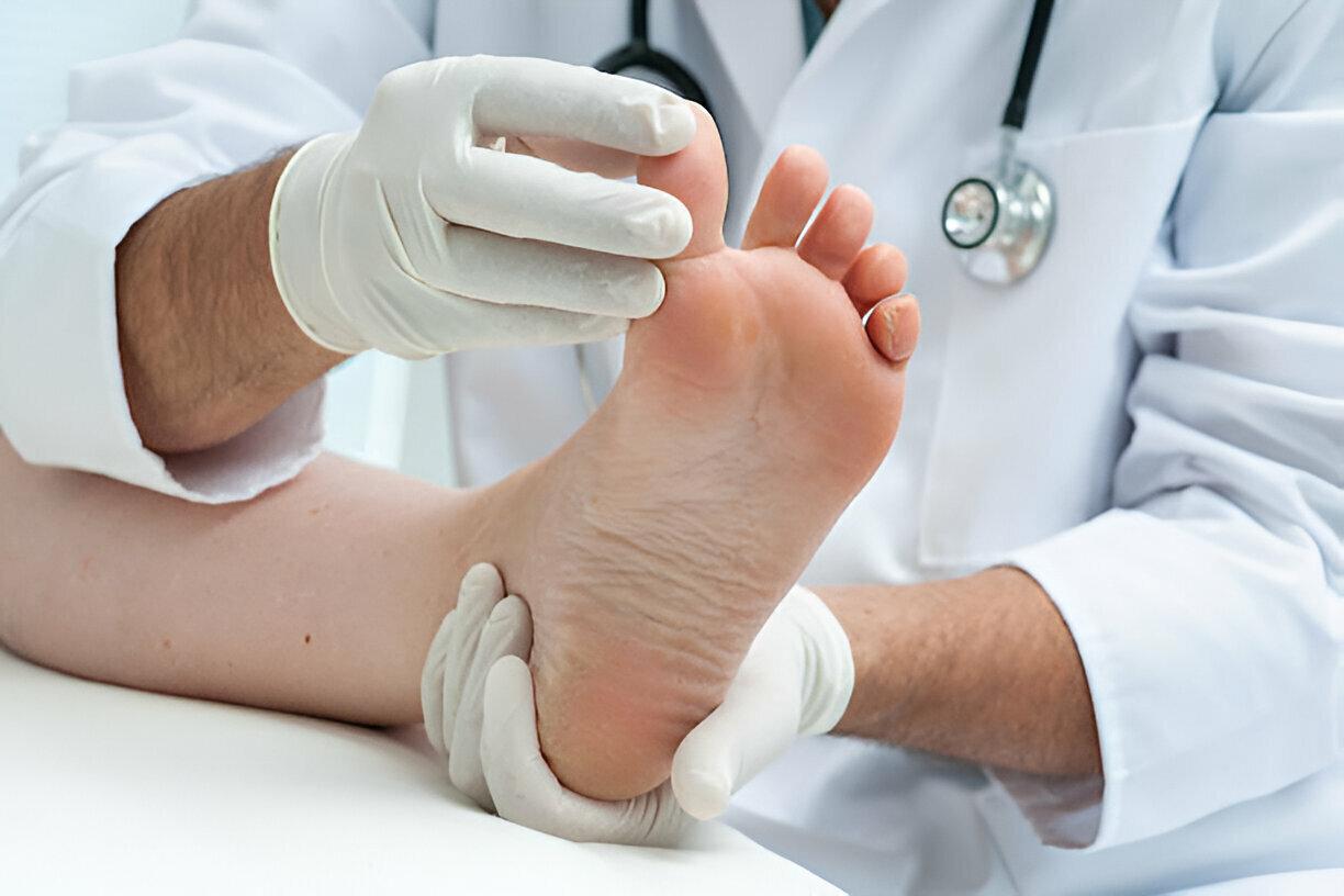 plantar fasciitis in heel treatment